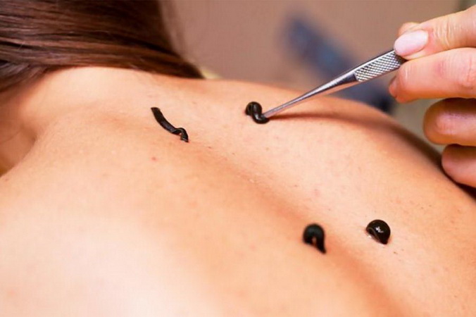 оздоровительные санатории для детей с родителями