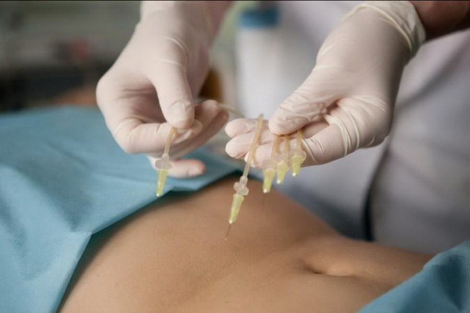 купить путевку по акции в санаторий